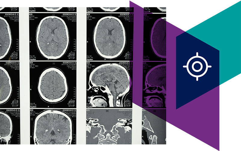 Radiomics disease detection & characterization