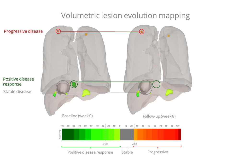 Radiomics volumetric lesion evolution mapping 